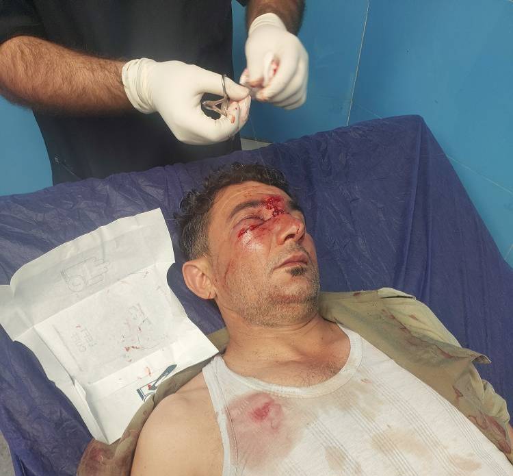 مصدومیت دو محیط‌بان پارک ملی کرخه در مقابله با شکارچیان غیرمجاز؛ ۲ متهم دستگیر شدند