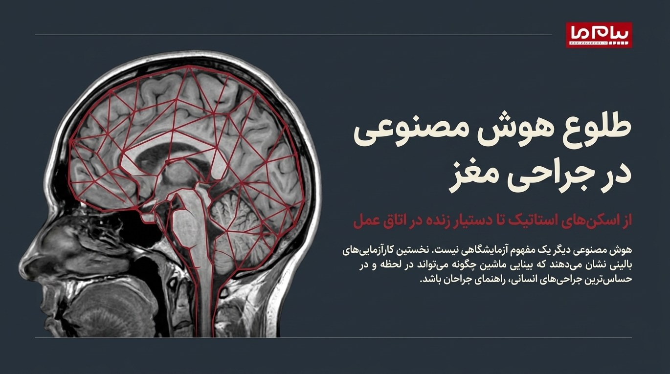 نخستین جراحی مغز جهان با دستیاری زنده هوش مصنوعی با موفقیت انجام شد +اینفوگرافی
